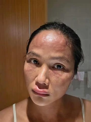 H'Hen Niê gặp rắc rối sức khỏe sau sinh, Ngọc Hân đồng cảm vì từng trải qua