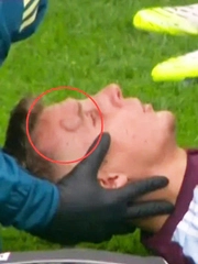 Hậu vệ Aston Villa u đầu vì va chạm với đồng đội Emiliano Martinez