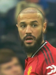 Fan rần rần phát hiện sao Man Utd cấy tóc