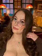 Bộ ngực quá khổ khiến cô gái cong vẹo cột sống