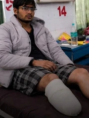 Chàng trai tự cắt chân tìm suất ưu tiên vào trường y, tin nổi không?