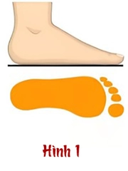 Quiz: Hình dạng vòm bàn chân tiết lộ gì về con người bạn?