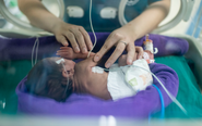 Úc phát triển nhau thai nhân tạo, mở ra hy vọng mới cho trẻ sinh non