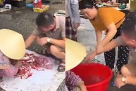 Thanh niên đỏ mặt vì bị cua kẹp