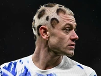 Ngôi sao người Na Uy gây sốc với kiểu tóc quái dị