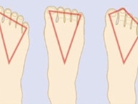 Nhìn dáng bàn chân, đoán ngay tính cách thật của bạn