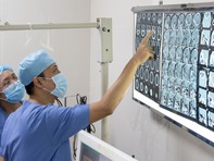 Hàng xóm dùng đũa nhựa đâm vào mắt, nhãn cầu phải của bệnh nhân bị biến dạng nặng