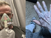 Hoảng hốt nhập viện vì da chuyển... xanh, tìm ra 'thủ phạm' là thứ không ai ngờ