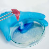 Podcast: Cần hiểu rõ để phòng tránh nhiễm khuẩn Salmonella có thể gây ngộ độc nặng