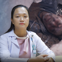 Podcast: Sự thật về việc uống nước tiểu để duy trì sự sống