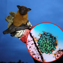 Podcast: Cảnh báo nguy cơ bùng phát đại dịch từ vi rút Nipah gây tử vong từ 40-75%