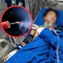 Thêm 2 học sinh bị thương vì tự chế pháo theo hướng dẫn trên mạng