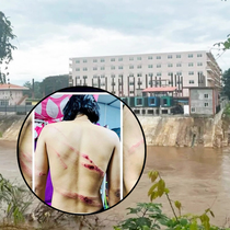 Ký ức kinh hoàng của các nữ nạn nhân thoát khỏi ổ lừa đảo ở Myanmar