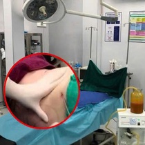 Lời khai của bác sĩ 'dỏm' thực hiện hàng trăm ca hút mỡ chui tại TP.HCM