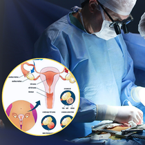 Cơn đau bụng cảnh báo khối u buồng trứng ở trẻ em