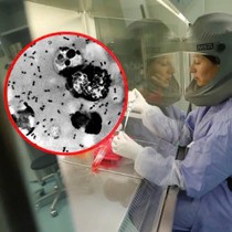 Dịch hạch thể phổi nguy hiểm đến mức nào?