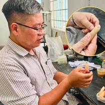 Người đàn ông ngồi xe lăn hơn 20 năm mang lại sự tự tin cho những bệnh nhân mất ngón tay