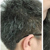 Vì sao nhiều người trẻ tóc bạc sớm?