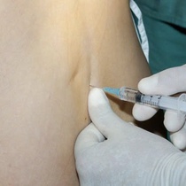 Những biến chứng có thể gặp sau gây tê tủy sống khi sinh mổ