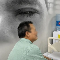 Bệnh nhân ung thư bất ngờ chảy máu mắt, xuất huyết tiêu hóa sau khi bồi bổ bằng thịt chó