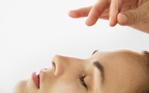Thận trọng với bệnh liệt dây thần kinh số 7 ngoại biên