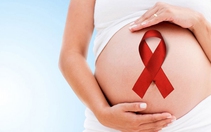 Những điều cần biết về dự phòng lây truyền HIV từ mẹ sang con