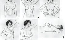 Nhận biết sớm ung thư vú