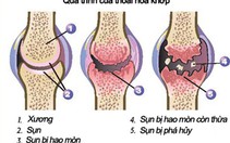 Giảm tiến trình thoái hóa khớp