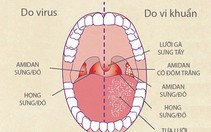 Bệnh viêm họng mùa lạnh