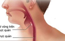 Nuốt khó là triệu chứng thường gặp của ung thư thực quản