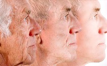 Trẻ lại 10 tuổi với công nghệ Laser Liposonic không phẫu thuật