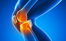 'Vũ khí mới' hứa hẹn điều trị thoái hóa khớp