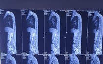 Cứu cháu bé 9 tuổi có thể nguy kịch chỉ vì một vết xước