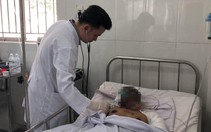 Tài xế xe bồn phỏng nặng, đang điều trị ở bệnh viện Chợ Rẫy