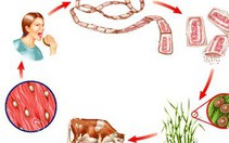 Phát hiện ổ bệnh 108 người nhiễm sán dây lợn tại Bình Phước