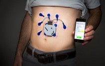 Xuất hiện thiết bị đeo IoT có thể chẩn đoán các bệnh về dạ dày
