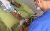 Kinh hoàng biến chứng bàn chân do mua thuốc trị tiểu đường