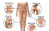 Thoái hóa khớp ở người cao tuổi