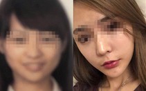 Không qua được cổng an ninh vì phẫu thuật thẩm mỹ