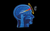 Cấm hay không cấm vũ khí sát thương tự động