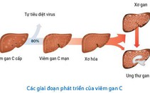 Biểu hiện viêm gan C ở phụ nữ