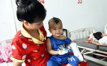 Hồi sinh bàn tay đứt lìa cho bé 1 tuổi