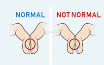 Ba dấu hiệu ở ngón tay cảnh báo bạn có thể bị ung thư phổi