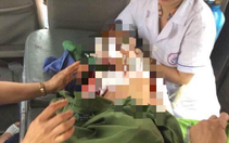 Lại một trẻ nguy kịch vì bị chó nhà nuôi tấn công