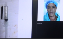 Nửa chiếc đũa nằm trong hốc mắt bệnh nhân suốt 4 năm