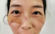 Bác sĩ ở Vũ Hán phải mặc tã làm việc, bị đánh và thiếu tiếp tế