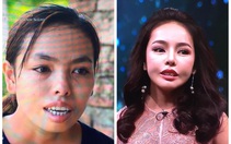 Cô gái bị miệt thị ngoại hình trở nên xinh đẹp hơn nhờ phẫu thuật thẩm mỹ