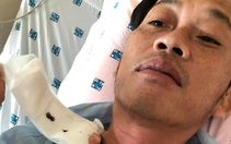 Hoài Linh từng đến Bệnh viện Chợ Rẫy điều trị ung thư tuyến giáp