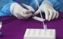 Vụ nâng khống giá kit test COVID-19: Sở Y tế Nghệ An nói gì?