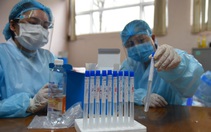 Đồng Nai mua kit test của Việt Á giá hơn 500.000 đồng